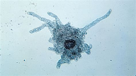 Brainia pulvinata: A microscopic amoeba that'll have you thinking Wow, this single-celled organism has got it going on!