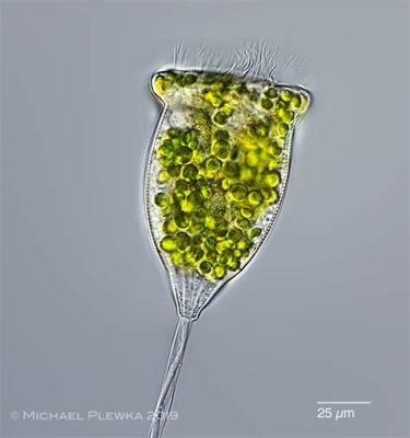 Vorticella! A Ciliate Micro-Marvel That Makes Your Water Go Round and Round!