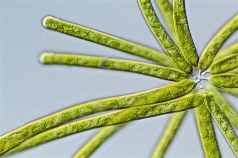  Yellow-Green Algae: A Tiny Beast That Fuels Aquatic Ecosystems With Its Remarkable Photosynthetic Abilities!